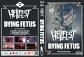 DyingFetus_2015-06-19_ClissonFrance_DVD_1cover.jpg
